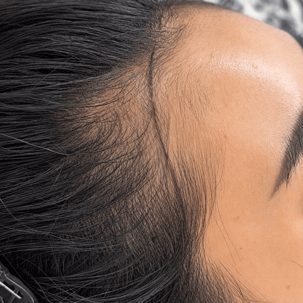 Scatter 紋髮|術前